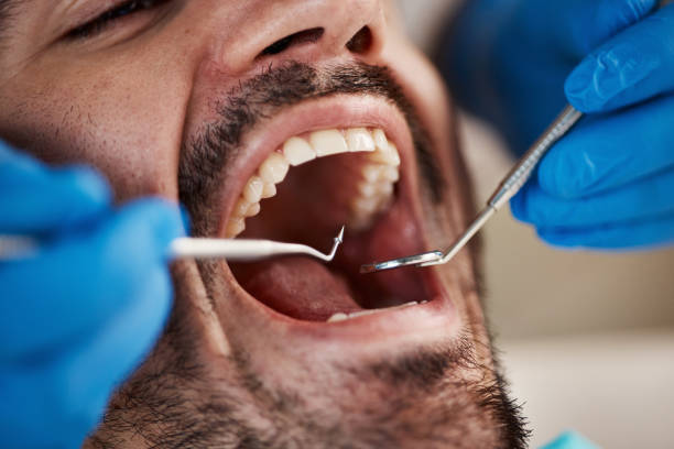 Best Emergency Care for Gum Disease in Somerset, NJ